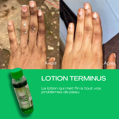 Lotion Terminus